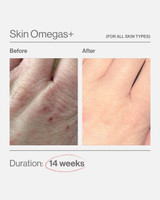 Skin Omegas+