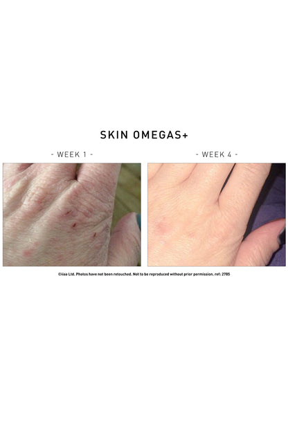 Skin Omegas+